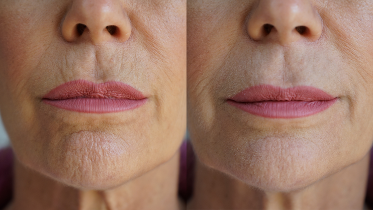 PRAI Ageless Lip & Line Filler | Softlight Beauty